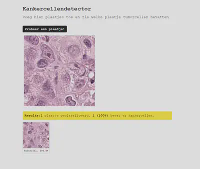 Example of the webapp for cell classification.